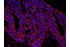 Immunofluorescence (IF) image for anti-A Kinase (PRKA) Anchor Protein 1 (AKAP1) (AA 375-425) antibody (ABIN7448928) (AKAP1 抗体  (AA 375-425))