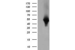 Western Blotting (WB) image for anti-Haptoglobin (HP) antibody (ABIN1498579) (Haptoglobin 抗体)