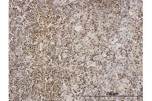 Immunoperoxidase of monoclonal antibody to TNKS on formalin-fixed paraffin-embedded human lymph node. (TNKS 抗体  (AA 1017-1124))