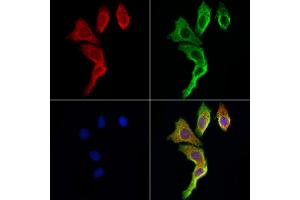 ABIN6265740 and ABIN6273021 staining Hela cells by IF/ICC. (TRIM44 抗体  (Internal Region))
