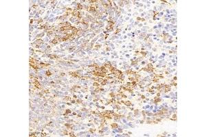 Immunohistochemistry (Paraffin-embedded Sections) (IHC (p)) image for anti-Interleukin-27 Subunit alpha (IL27) antibody (ABIN7074367)