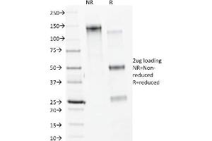 SDS-PAGE (SDS) image for anti-Calnexin (CANX) (AA 1-300), (N-Term) antibody (ABIN6940952)