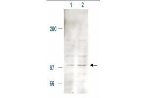 Immunoblotting. (MDM2 抗体  (pSer185))