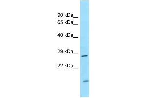 WB Suggested Anti-CD82 Antibody Titration: 1. (CD82 抗体  (Middle Region))