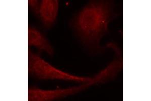 Immunofluorescence (IF) image for anti-Nuclear Factor-kB p65 (NFkBP65) (pSer529) antibody (ABIN1870581) (NF-kB p65 抗体  (pSer529))