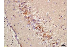 Formalin-fixed and paraffin embedded rat brain labeled with Rabbit Anti-Epac2 Polyclonal Antibody, Unconjugated (ABIN2173847) at 1:200 followed by conjugation to the secondary antibody and DAB staining (RAPGEF4 抗体  (AA 151-250))