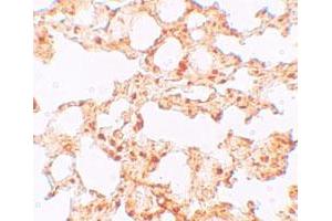 Immunohistochemical staining of mouse lung cells with SLC39A6 polyclonal antibody  at 5 ug/mL. (SLC39A6 抗体  (Internal Region))