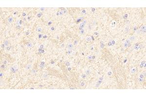 Detection of SIRT2 in Mouse Cerebrum Tissue using Polyclonal Antibody to Sirtuin 2 (SIRT2) (SIRT2 抗体  (AA 65-340))