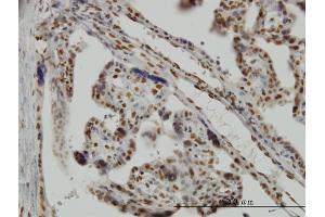 Immunostaining (ISt) image for anti-Musashi Homolog 1 (Drosophila) (MSI1) (AA 1-87) antibody (ABIN518032)