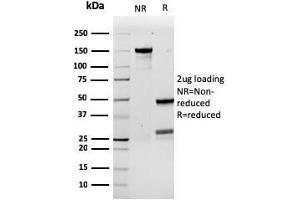 SDS-PAGE Analysis Purified G-CSF Recombinant Mouse Monoclonal Antibody (rCSF3/900). (Recombinant G-CSF 抗体)