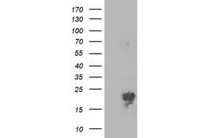 Western Blotting (WB) image for anti-Phosphomevalonate Kinase (PMVK) antibody (ABIN1500302)
