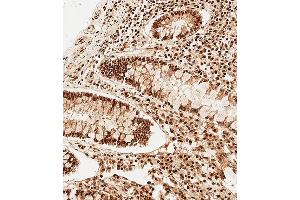 Immunohistochemical analysis of paraffin-embedded Human colon tissue using A performed on the Leica® BOND RXm. (SNRPD3 抗体  (N-Term))