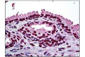 Immunohistochemistry (IHC) image for anti-Distal-Less Homeobox Protein 2 (DLX2) antibody (ABIN781967) (DLX2 抗体)