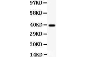 Anti-AAMP Picoband antibody,  All lanes: Anti AAMP  at 0. (AAMP 抗体  (AA 235-434))