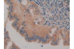Immunohistochemistry (IHC) image for anti-Calnexin (CANX) (AA 263-482) antibody (ABIN7440107)