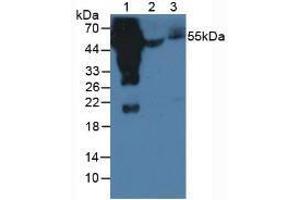 Western blot analysis of (1) Human Serum, (2) Porcine Serum and (3) Mouse Serum. (兔 anti-人 IgG4 (AA 222-327) Antibody)