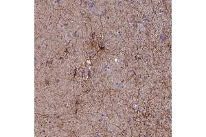 Immunohistochemical staining of human hippocampus with USP37 polyclonal antibody  shows distinct cytoplasmic positivity in astrocytes at 1:10-1:20 dilution. (USP37 抗体)