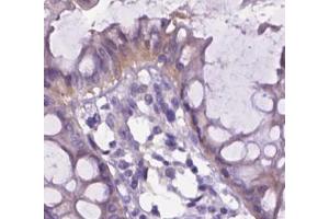 Immunohistochemical analysis of paraffin-embedded Human colon tissue labeling Integrin beta 7 (Integrin beta 7 抗体  (Internal Region))