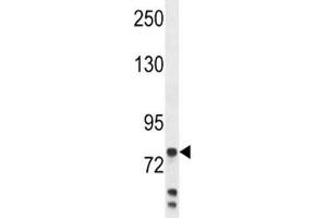 Anti-Myeloperoxidase antibody western blot analysis in MDA-MB231 lysate. (Myeloperoxidase 抗体  (AA 420-448))