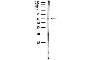 anti-MLC1 antibody