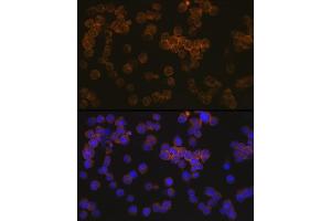 Immunofluorescence (IF) image for anti-Wiskott-Aldrich Syndrome (Eczema-thrombocytopenia) (WAS) antibody (ABIN7271381)