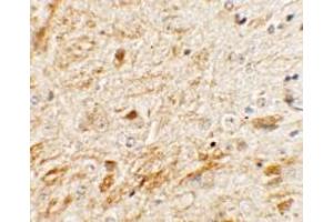 Immunohistochemistry of TMEM106A in mouse brain tissue with TMEM106A Antibody at 5 µg/ml. (TMEM106A 抗体  (N-Term))