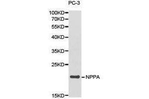 Western Blotting (WB) image for anti-Natriuretic Peptide A (NPPA) antibody (ABIN1873936) (NPPA 抗体)