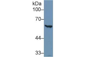 Detection of G6PD in Human Hela cell lysate using Polyclonal Antibody to Glucose-6-phosphate Dehydrogenase (G6PD) (Glucose-6-Phosphate Dehydrogenase 抗体)