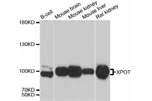 Western blot analysis of extracts of various cell lines, using XPOT antibody (ABIN6292909) at 1:3000 dilution. (XPOT 抗体)