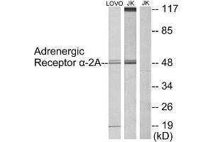 Western Blotting (WB) image for anti-Alpha-2A Adrenergic Receptor (ADRA2A) (C-Term) antibody (ABIN1849124) (ADRA2A 抗体  (C-Term))