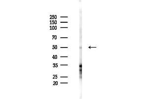 anti-Tripartite Motif Containing 35 (TRIM35) (N-Term) antibody