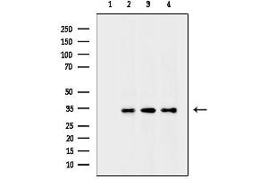 Western blot analysis of lysates from 3-L1 cells(heat-shock treatment) HepG2 cells(heat-shock treatment) Hela cells(heat-shock treatment), using Phospho-CDK6 (Tyr292) Antibody.