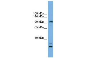 CCDC110 antibody used at 0. (CCDC110 抗体  (Middle Region))