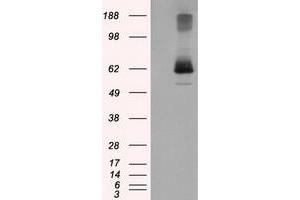HEK293T cells were transfected with the pCMV6-ENTRY control (Left lane) or pCMV6-ENTRY LIPG (Right lane) cDNA for 48 hrs and lysed. (LIPG 抗体)