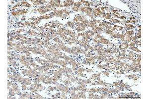 IHC analysis of ALDH3A1 using anti-ALDH3A1 antibody (ABIN7601680).