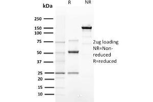 SDS-PAGE (SDS) image for anti-Cyclin E1 (CCNE1) (AA 10-176) antibody (ABIN6940994)