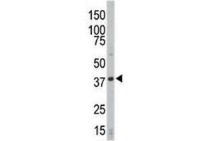 Western Blotting (WB) image for anti-Cyclin-Dependent Kinase 4 (CDK4) (AA 273-305) antibody (ABIN3030613)