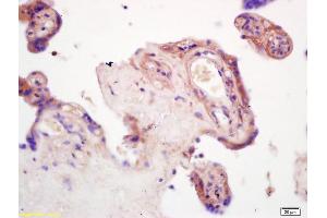 Formalin-fixed and paraffin embedded rat brain tissue labeled with Anti--GDF15/MIC-1 Polyclonal Antibody, Unconjugated (ABIN704561) at 1:200, followed by conjugation to the secondary antibody and DAB staining (GDF15 抗体  (AA 221-308))