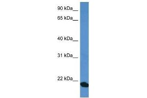Western Blot showing COMMD1 antibody used at a concentration of 1 ug/ml against Fetal Heart Lysate (COMMD1 抗体  (C-Term))