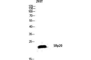 Western Blotting (WB) image for anti-serine/arginine-Rich Splicing Factor 3 (SRSF3) (C-Term) antibody (ABIN3187055)