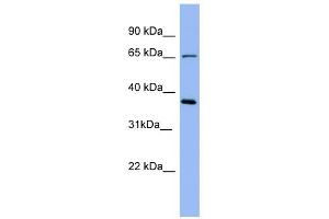 Uromodulin antibody used at 1 ug/ml to detect target protein. (Uromodulin 抗体  (Middle Region))
