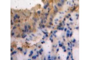 IHC-P analysis of Lung tissue, with DAB staining. (SEMA3E 抗体  (AA 581-669))