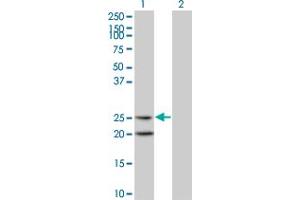 Western Blot analysis of IL6 expression in transfected 293T cell line by IL6 monoclonal antibody (M06), clone 4H5. (IL-6 抗体  (AA 29-212))