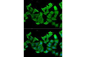 Immunofluorescence analysis of A549 cells using HAGH antibody (ABIN5973978). (HAGH 抗体)