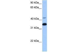 GNB2 antibody used at 1 ug/ml to detect target protein. (GNB2 抗体)