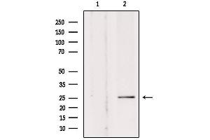 Western blot analysis of extracts from rat brain, using SOD-3  Antibody. (SOD3 抗体  (Internal Region))