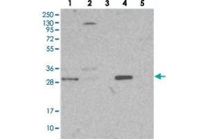 Western blot analysis of Lane 1: RT-4, Lane 2: U-251 MG, Lane 3: Human Plasma, Lane 4: Liver, Lane 5: Tonsil with NIT2 polyclonal antibody  at 1:250-1:500 dilution. (NIT2 抗体)