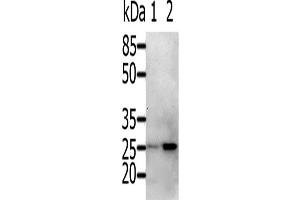 Western Blotting (WB) image for anti-RAB5A, Member RAS Oncogene Family (RAB5A) antibody (ABIN2425528) (RAB5 抗体)