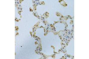 Immunohistochemistry of paraffin-embedded rat lung using HNRNPK Antibody.
