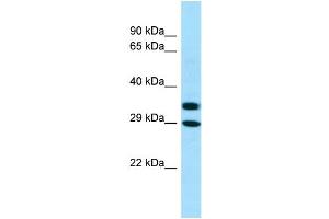 WB Suggested Anti-AKR1A1 Antibody Titration: 1. (AKR1A1 抗体  (C-Term))
